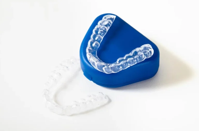 clear-aligner